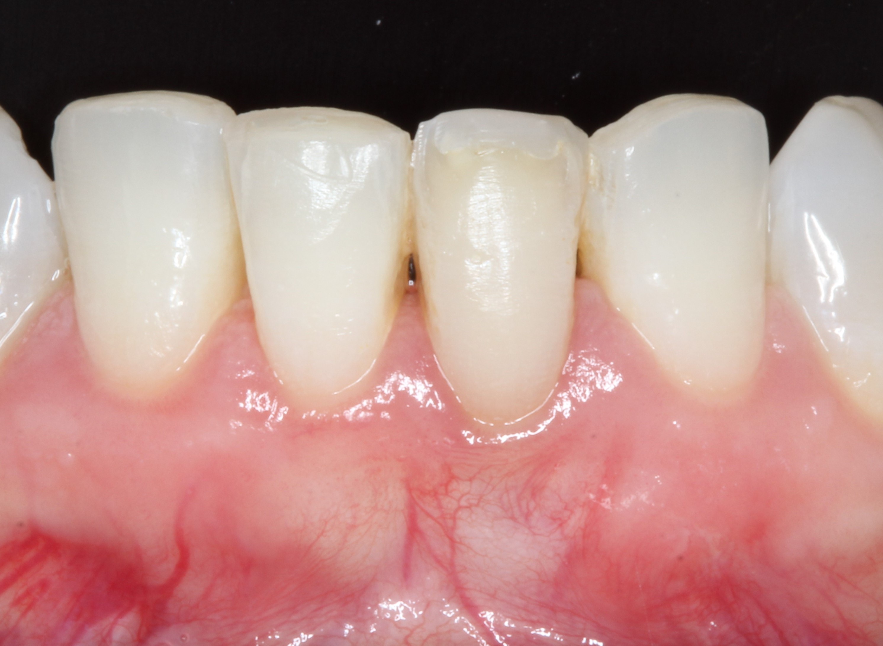 Tratamientos de periodoncia