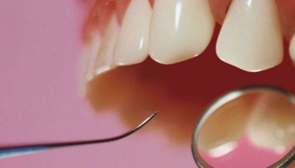 composite-dental Uso del composite dental