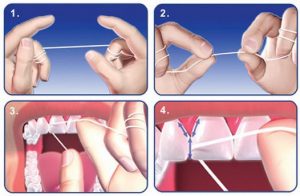 importancia usar hilo dental - Luis Sánchez dental