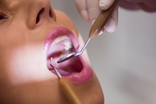 dentista-examinando-dientes-paciente-femenino_107420-65306 Dentista examinando la paciente tiene dientes con sarro