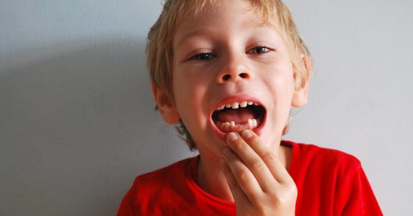 traumatismo dental 4 traumatismo dental, qué es