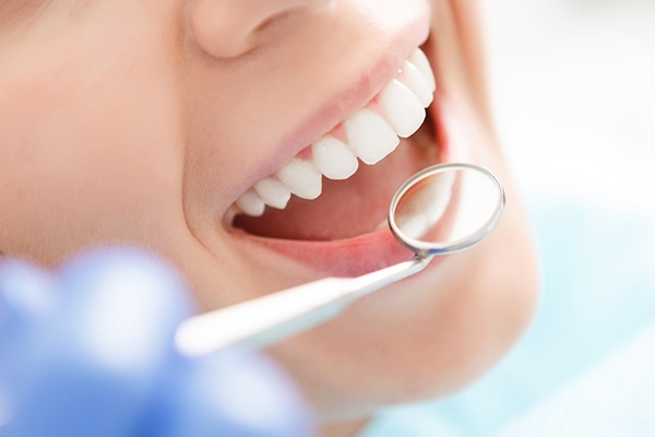 Gingivectomía - Clínica dental Luis Sánchez