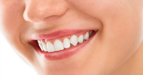 gingivitis 3 qué es la gingivitis - Gingivectomía