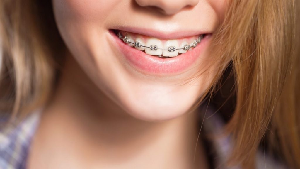 Tratamientos para la maloclusión - Clínica dental Luis Sánchez