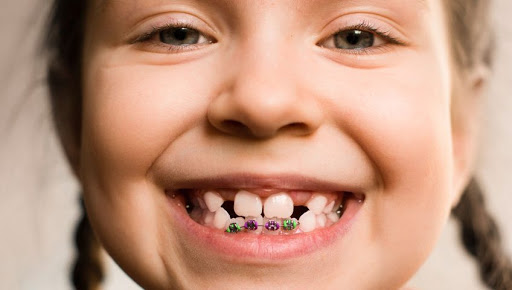 niña necesita ortodoncia