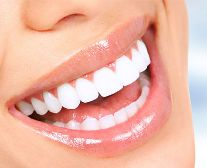 estetica-dental estética dental