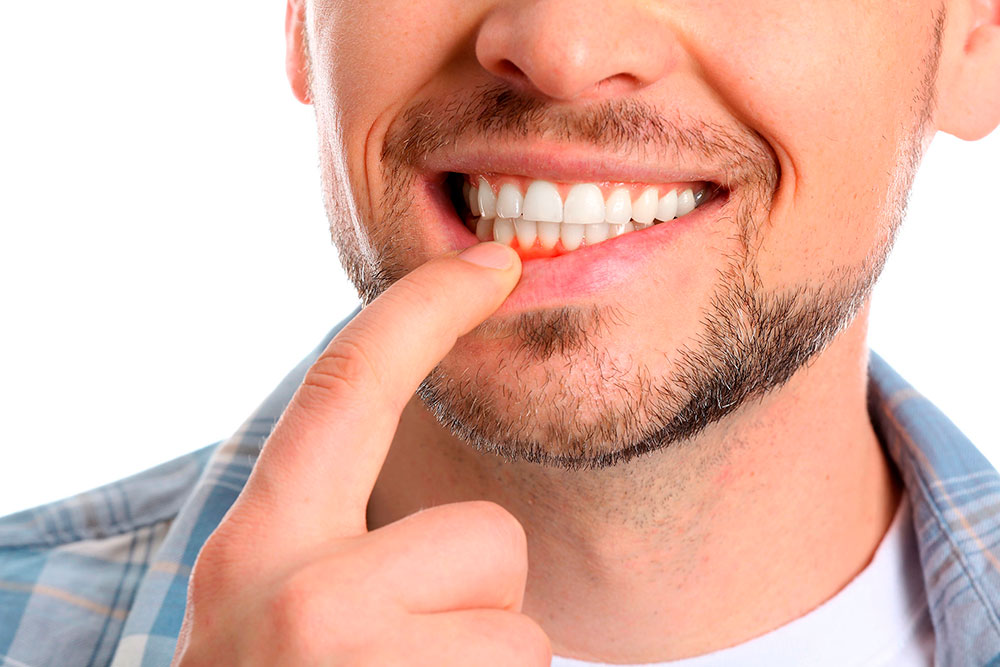 Pulpitis reversible - Luis Sánchez clínica dental Getxo