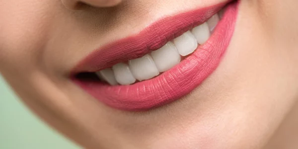 manchas-blancas-en-los-dientes-belen-perez