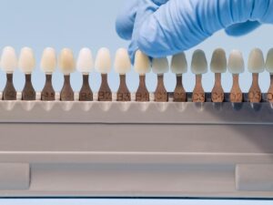 Diferentes tonalidades de los dientes